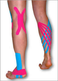 Kinesio Tape on legs